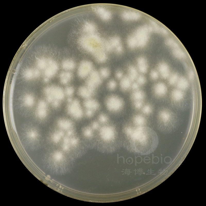 黑曲霉菌  有黑色孢子，白色菌丝