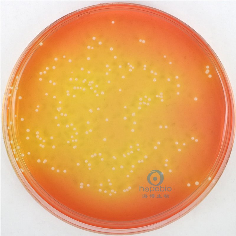 金黄色葡萄球菌在甘露醇盐琼脂培养基上的生长特征