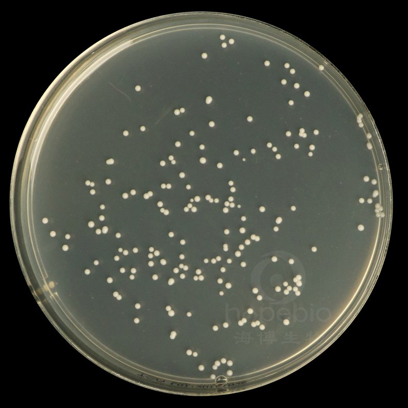 白色念珠菌  奶油色菌落